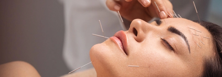 Acupuncture Lake Villa IL Facial Acupuncture