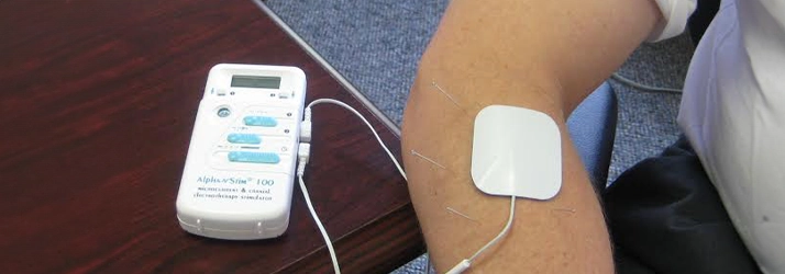 Acupuncture Lake Villa IL Microcurrent Therapy Device